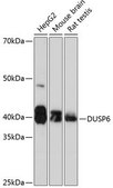 Anti-DUSP6 antibody produced in rabbit