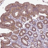 Anti-ALDH2 antibody produced in rabbit Prestige Antibodies® Powered by Atlas Antibodies, affinity isolated antibody, buffered aqueous glycerol solution