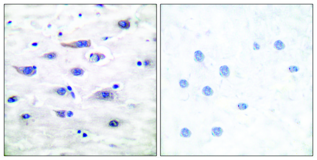 Anti-GLUR1 antibody produced in rabbit affinity isolated antibody
