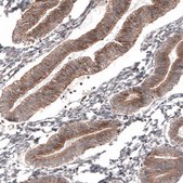 Monoclonal Anti-ATG5 antibody produced in mouse Prestige Antibodies® Powered by Atlas Antibodies, clone CL9508, purified immunoglobulin, buffered aqueous glycerol solution