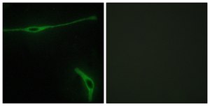 Anti-LAMA2 antibody produced in rabbit affinity isolated antibody