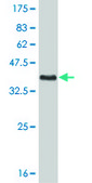 Monoclonal Anti-PGR antibody produced in mouse clone 5D10, purified immunoglobulin, buffered aqueous solution