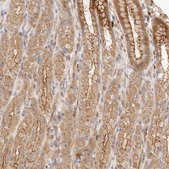 Anti-IL1R2 antibody produced in rabbit Prestige Antibodies® Powered by Atlas Antibodies, affinity isolated antibody, buffered aqueous glycerol solution, ab2