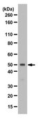 Anti-Equilibrative Nucleoside Transporter 1 Antibody from rabbit, purified by affinity chromatography