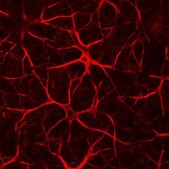 Anti-Neurofilament H Antibody Chemicon®, from chicken