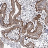 Anti-PPAT antibody produced in rabbit Prestige Antibodies® Powered by Atlas Antibodies, affinity isolated antibody, buffered aqueous glycerol solution