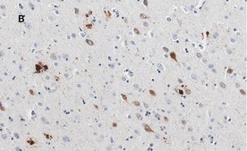 Anti-APP Antibody, clone 5D16, ZooMAb® Rabbit Monoclonal recombinant, expressed in HEK 293 cells