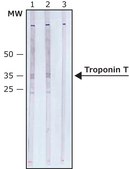 单克隆抗肌钙蛋白 T 小鼠抗 clone JLT-12, purified from hybridoma cell culture