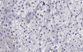 Anti-TrkA Antibody, clone 2J4 ZooMAb® Rabbit Monoclonal recombinant, expressed in HEK 293 cells