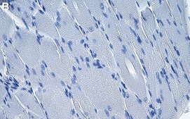 Anti-Hexokinase-2 Antibody, clone 1F3 ZooMAb® Rabbit Monoclonal recombinant, expressed in HEK 293 cells