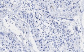 Anti-POLR2A Antibody, clone 3G21 ZooMAb® Rabbit Monoclonal recombinant, expressed in HEK 293 cells