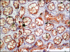 Anti-FUS antibody produced in rabbit ~1.0 mg/mL, affinity isolated antibody