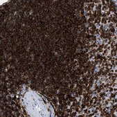 Anti-LCP1 antibody produced in rabbit Prestige Antibodies® Powered by Atlas Antibodies, affinity isolated antibody, buffered aqueous glycerol solution