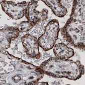 Monoclonal Anti-CS antibody produced in mouse Prestige Antibodies® Powered by Atlas Antibodies, clone CL2545, purified immunoglobulin, buffered aqueous glycerol solution