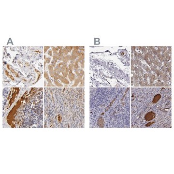 Anti-TF antibody produced in rabbit Ab1, Prestige Antibodies® Powered by Atlas Antibodies, affinity isolated antibody, buffered aqueous glycerol solution