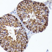 Anti-PRMT5 antibody produced in rabbit