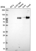 Anti-VCAM1 antibody produced in rabbit Prestige Antibodies® Powered by Atlas Antibodies, affinity isolated antibody