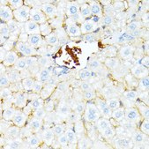 Anti-SPTA1 antibody produced in rabbit