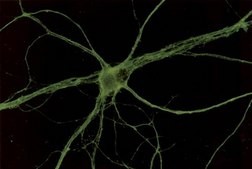 抗生长相关蛋白-43（GAP-43）抗体 Chemicon®, from rabbit