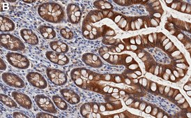 Anti-RSK-1 Antibody, clone 1C18 ZooMAb® Rabbit Monoclonal recombinant, expressed in HEK 293 cells