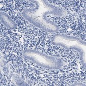 Anti-ACPP antibody produced in rabbit Prestige Antibodies® Powered by Atlas Antibodies, affinity isolated antibody, buffered aqueous glycerol solution