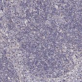 Anti-DDC antibody produced in rabbit Prestige Antibodies® Powered by Atlas Antibodies, affinity isolated antibody, buffered aqueous glycerol solution