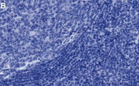 Anti-DNMT1 Antibody, clone 1L14 ZooMAb® Rabbit Monoclonal recombinant, expressed in HEK 293 cells