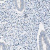 Anti-ART3 antibody produced in rabbit Prestige Antibodies® Powered by Atlas Antibodies, affinity isolated antibody, buffered aqueous glycerol solution