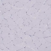 Anti-DDX20 antibody produced in rabbit Prestige Antibodies® Powered by Atlas Antibodies, affinity isolated antibody, buffered aqueous glycerol solution