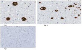 Anti-amyloid beta peptide (MOAB-2), pan Antibody, clone 6C3 clone 6C3, from mouse
