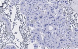 Anti-PPARγ Antibody, clone 1I19 ZooMAb® Rabbit Monoclonal recombinant, expressed in HEK 293 cells