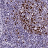 Anti-CDC20 antibody produced in rabbit Prestige Antibodies® Powered by Atlas Antibodies, affinity isolated antibody, buffered aqueous glycerol solution