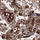 Monoclonal Anti-FN1 antibody produced in mouse Prestige Antibodies® Powered by Atlas Antibodies, clone CL3730, purified immunoglobulin, buffered aqueous glycerol solution