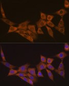 Anti-DCP1A antibody produced in rabbit