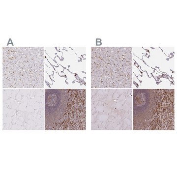 Anti-PYCARD antibody produced in rabbit Prestige Antibodies® Powered by Atlas Antibodies, affinity isolated antibody, buffered aqueous glycerol solution