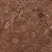 Monoclonal Anti-Adam10 Antibody Produced In Mouse Prestige Antibodies® Powered by Atlas Antibodies, clone CL13815, affinity isolated antibody, buffered aqueous glycerol solution