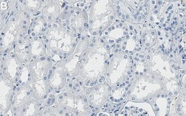 Anti-PDHA1 Antibody, clone 1B13 ZooMAb® Rabbit Monoclonal recombinant, expressed in HEK 293 cells