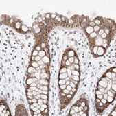 Anti-MRPL37 antibody produced in rabbit Prestige Antibodies® Powered by Atlas Antibodies, affinity isolated antibody, buffered aqueous glycerol solution, Ab1