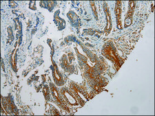 Anti-TUBA1C affinity isolated antibody