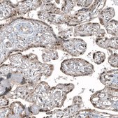 Monoclonal Anti-HDAC5 antibody produced in mouse Prestige Antibodies® Powered by Atlas Antibodies, clone CL8121, purified immunoglobulin, buffered aqueous glycerol solution