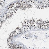 Anti-PARG antibody produced in rabbit Prestige Antibodies® Powered by Atlas Antibodies, affinity isolated antibody, buffered aqueous glycerol solution