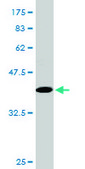 Monoclonal Anti-TWIST1, (C-terminal) antibody produced in mouse clone 2F8, purified immunoglobulin, buffered aqueous solution