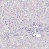 Anti-AGR3 antibody produced in rabbit Prestige Antibodies® Powered by Atlas Antibodies, affinity isolated antibody, buffered aqueous glycerol solution