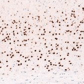 Monoclonal Anti-FOXP2 antibody produced in mouse Prestige Antibodies® Powered by Atlas Antibodies, clone CL5310, purified immunoglobulin, buffered aqueous glycerol solution