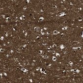 Anti-GAP43 antibody produced in rabbit Prestige Antibodies® Powered by Atlas Antibodies, affinity isolated antibody, buffered aqueous glycerol solution