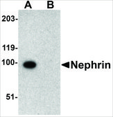 抗 Nephrin 兔抗 affinity isolated antibody, buffered aqueous solution