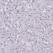 Anti-LMNB2 antibody produced in rabbit Prestige Antibodies® Powered by Atlas Antibodies, affinity isolated antibody, buffered aqueous glycerol solution