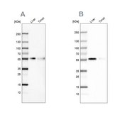 Anti-CD14 antibody produced in rabbit Prestige Antibodies® Powered by Atlas Antibodies, affinity isolated antibody, buffered aqueous glycerol solution