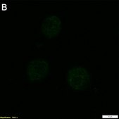 Anti-TNFα Antibody, clone 2E3 ZooMAb® Rabbit Monoclonal recombinant, expressed in HEK 293 cells