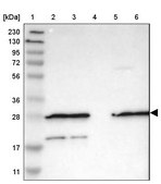 Anti-FNTA antibody produced in rabbit Prestige Antibodies® Powered by Atlas Antibodies, affinity isolated antibody, buffered aqueous glycerol solution